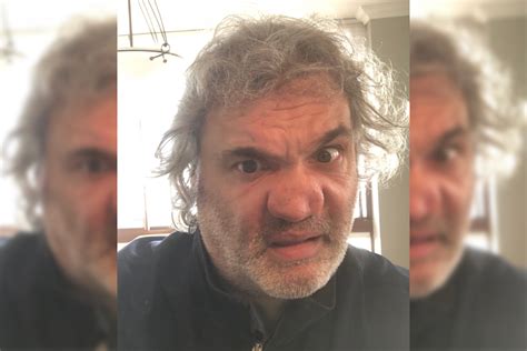 Artie Lange shares picture of hideously deformed nose due to。